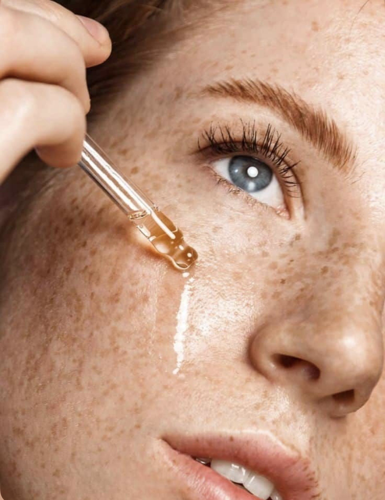 Tratamento para Melasma — imagem 3